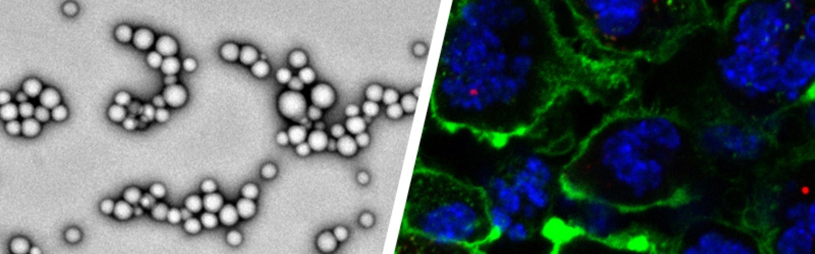 Purdue Researchers Fight Cancer Stories